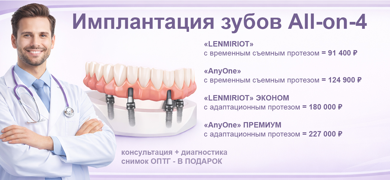 Имплантация зубов All-on-4